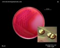 escherichia coli on endo